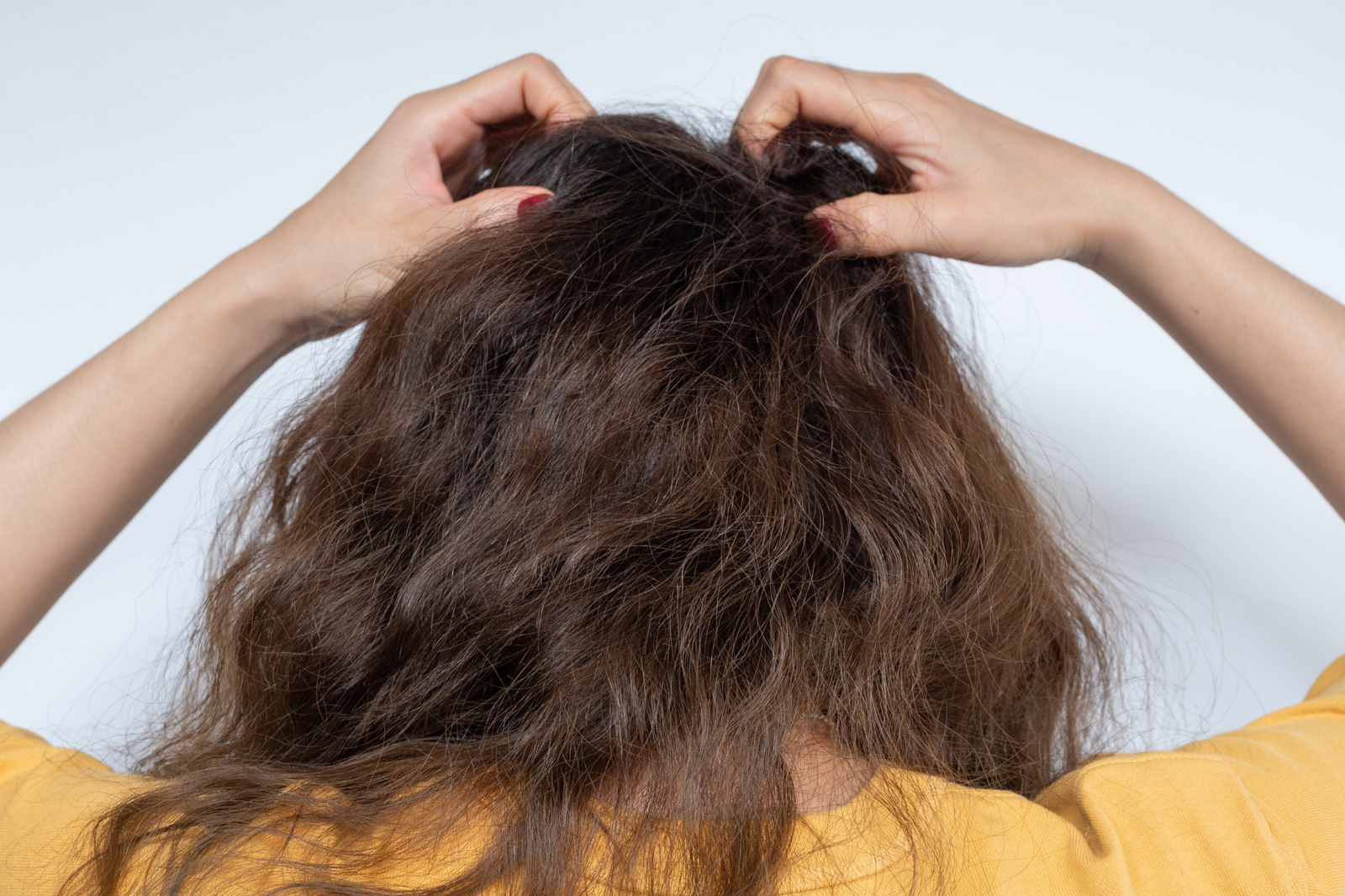 Woman scratchy her head, scalp